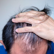 873a7516 img man density hair 1050050000000000000000